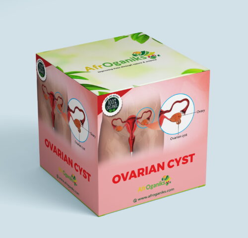 Ovarian Cyst